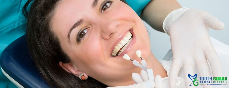 porcelain dental implants cost